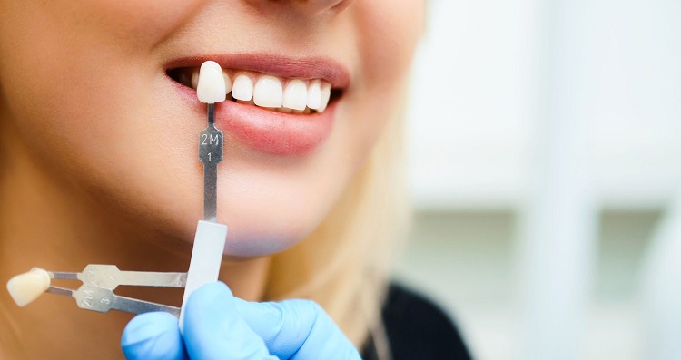 best electric toothbrush for crowns